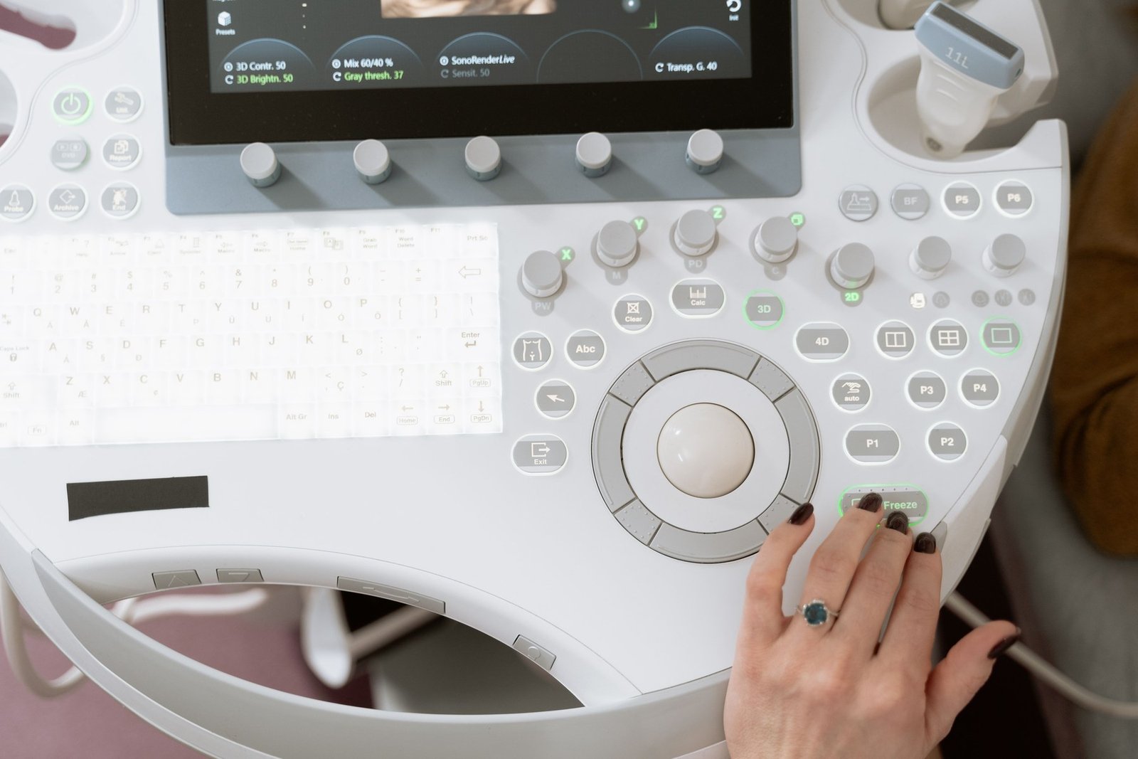 An ultrasound examination of the wrist