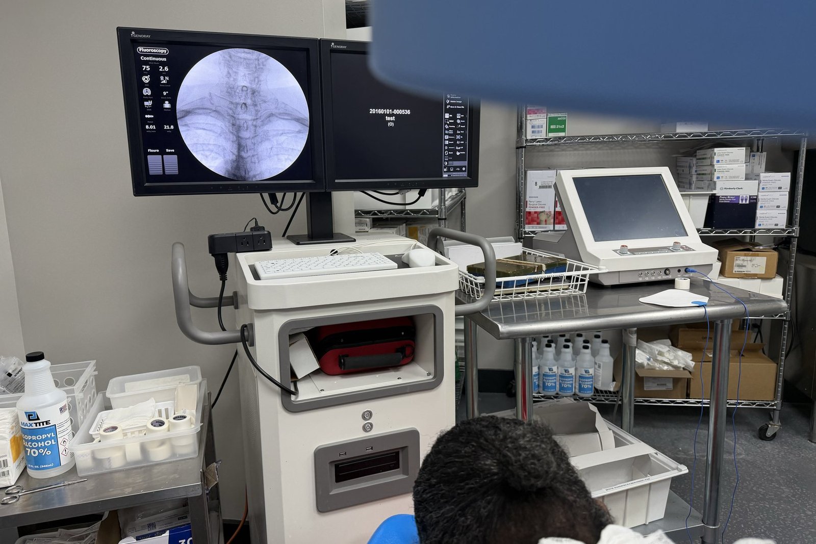 A patient positioned in our procedure suite for a cervical epidural steroid injection, the fluoroscopy monitor showing the cervical spine.